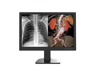 Медицинский монитор Jusha C61